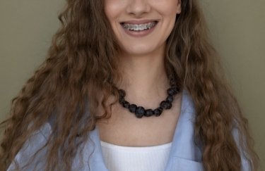 Період лікування металевими брекетами: скільки часу потрібно?